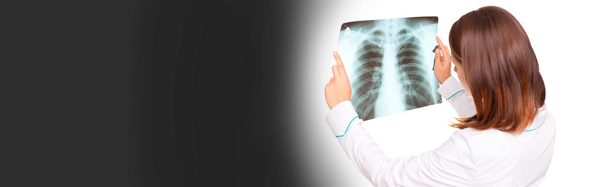 флюорография