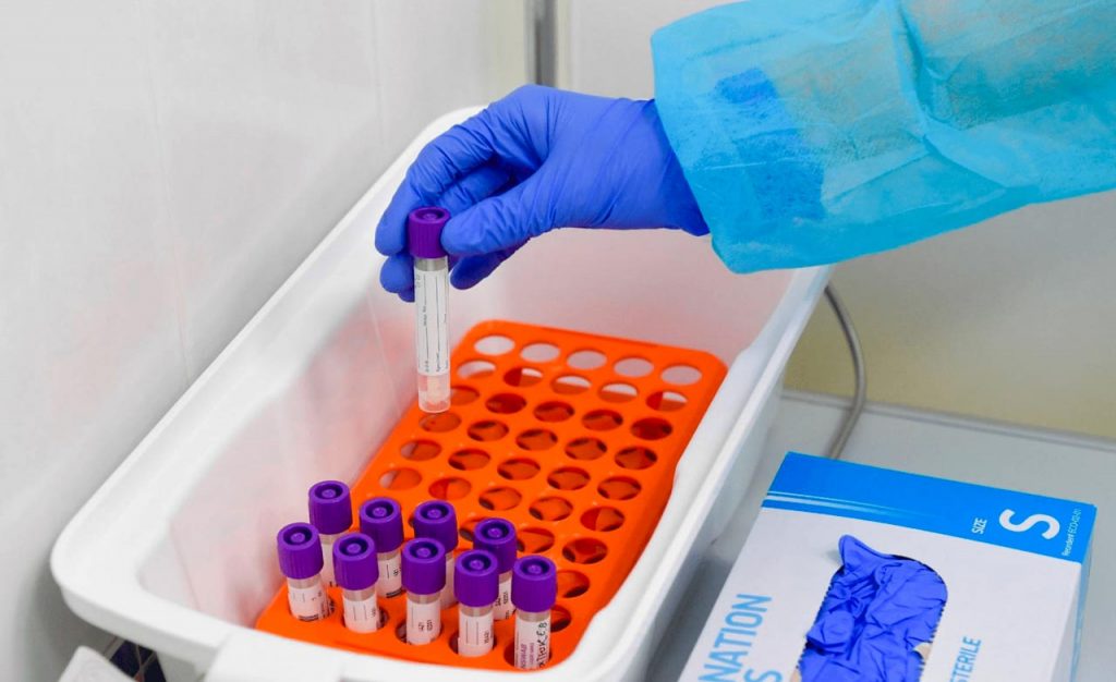 Количественный-тест-на-коронавирус